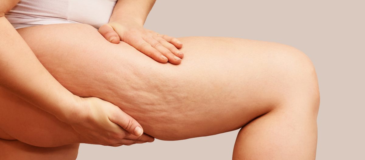 Traitement esthétique Emtone amincissement et anti-cellulite chez Centre Koel, Institut de Beauté et Centre Esthétique alternatif à la chirurgie