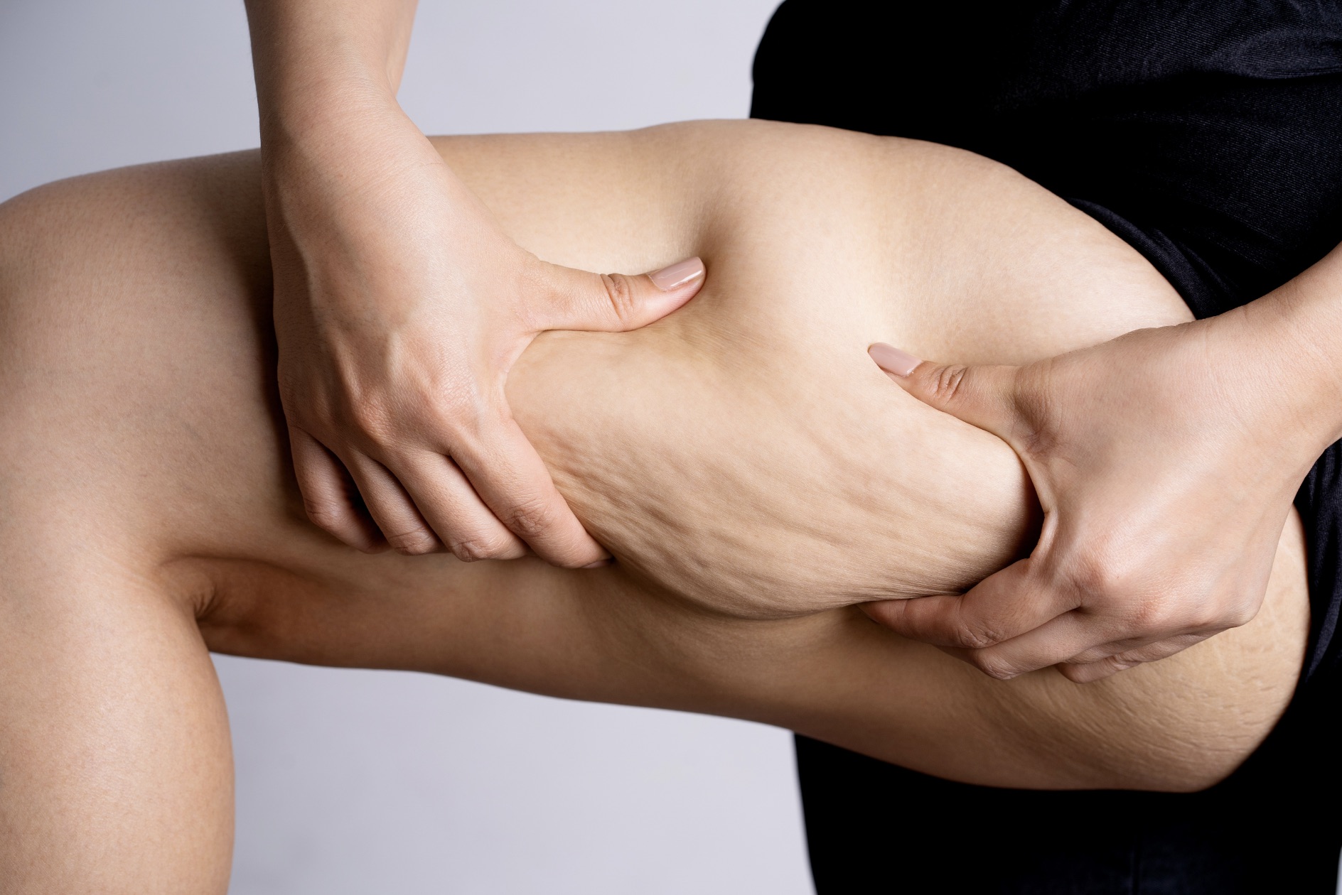 ADIPOCYTES : CES CELLULES GRAISSEUSES QUI DÉFIENT NOTRE SILHOUETTE PAR CENTRE KOEL