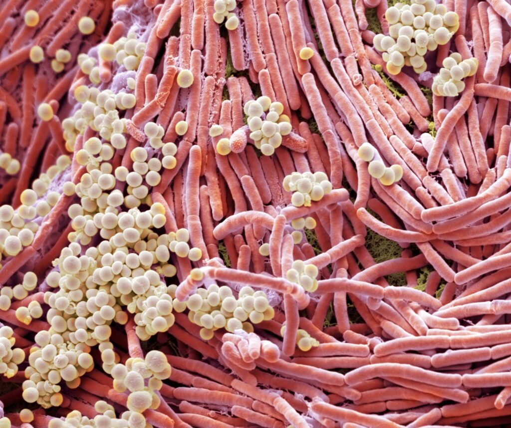 Microbiote Intestinal : prise en charge intégrale par les Centres Koel