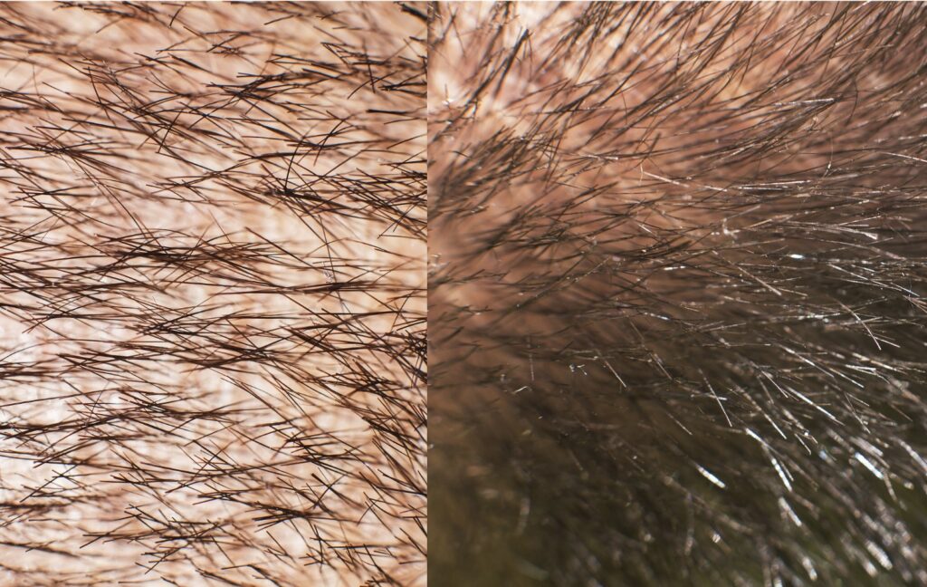 Les protocoles de soins du cheveu disponibles dans vos Centres Koel