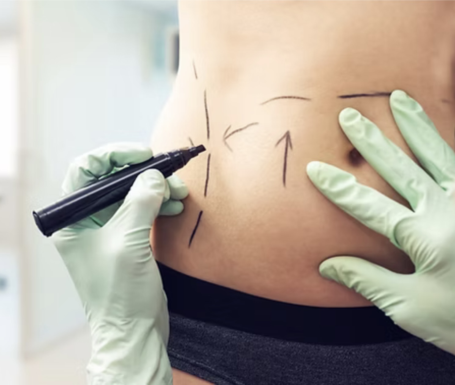 Accompagnement et massage post-opératoire Centre Koel