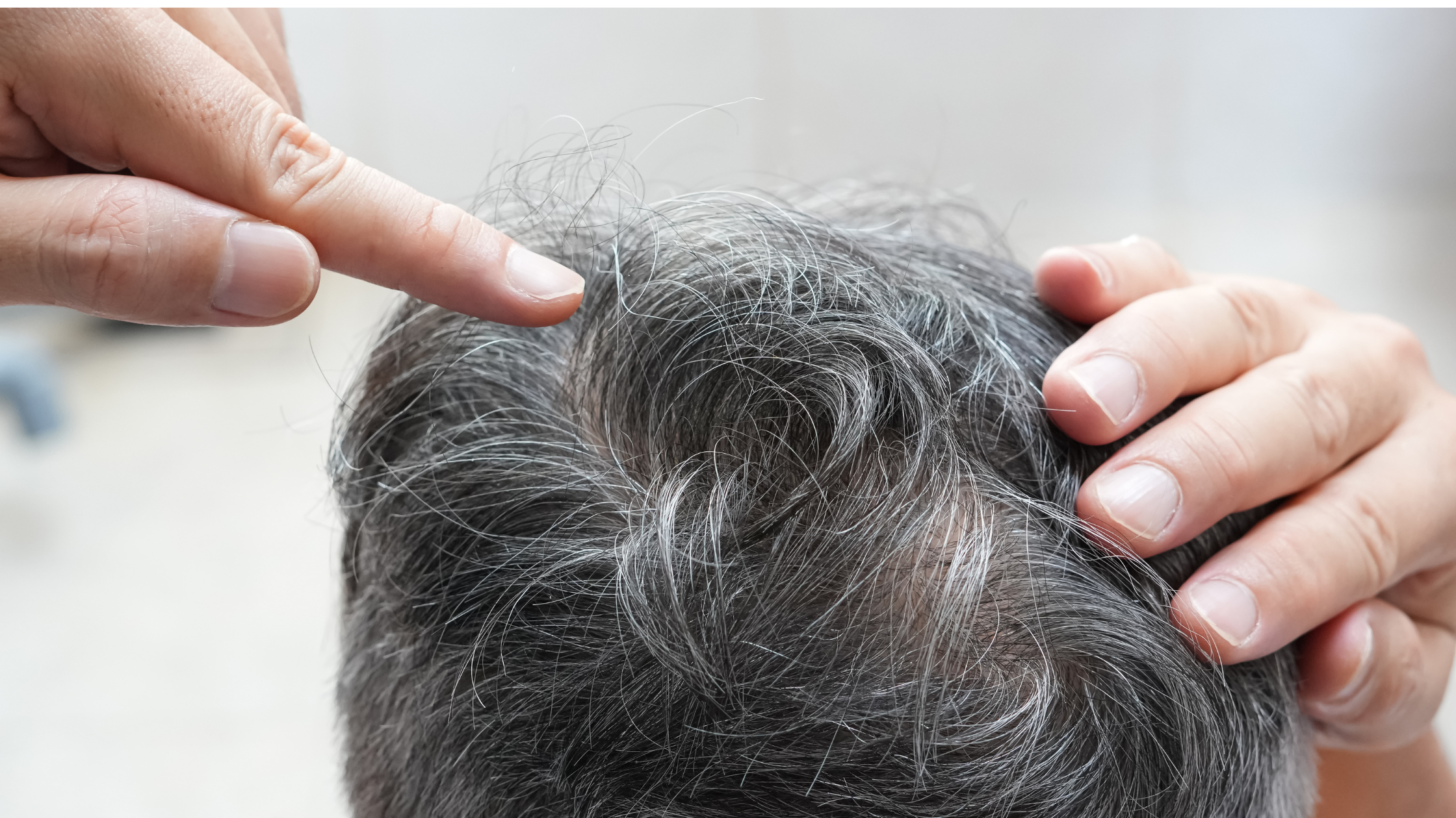 PP405 : Bientôt disponible. Les meilleurs traitements anti-chute et repousse capillaire disponibles sont chez Centre Koel.