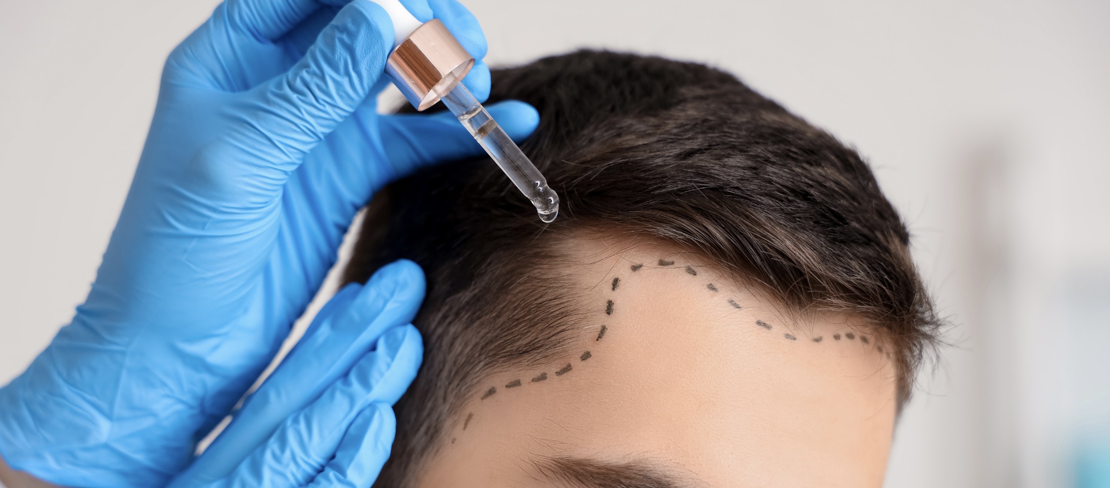 PP405 : Bientôt disponible. Les meilleurs traitements anti-chute et repousse capillaire disponibles sont chez Centre Koel.