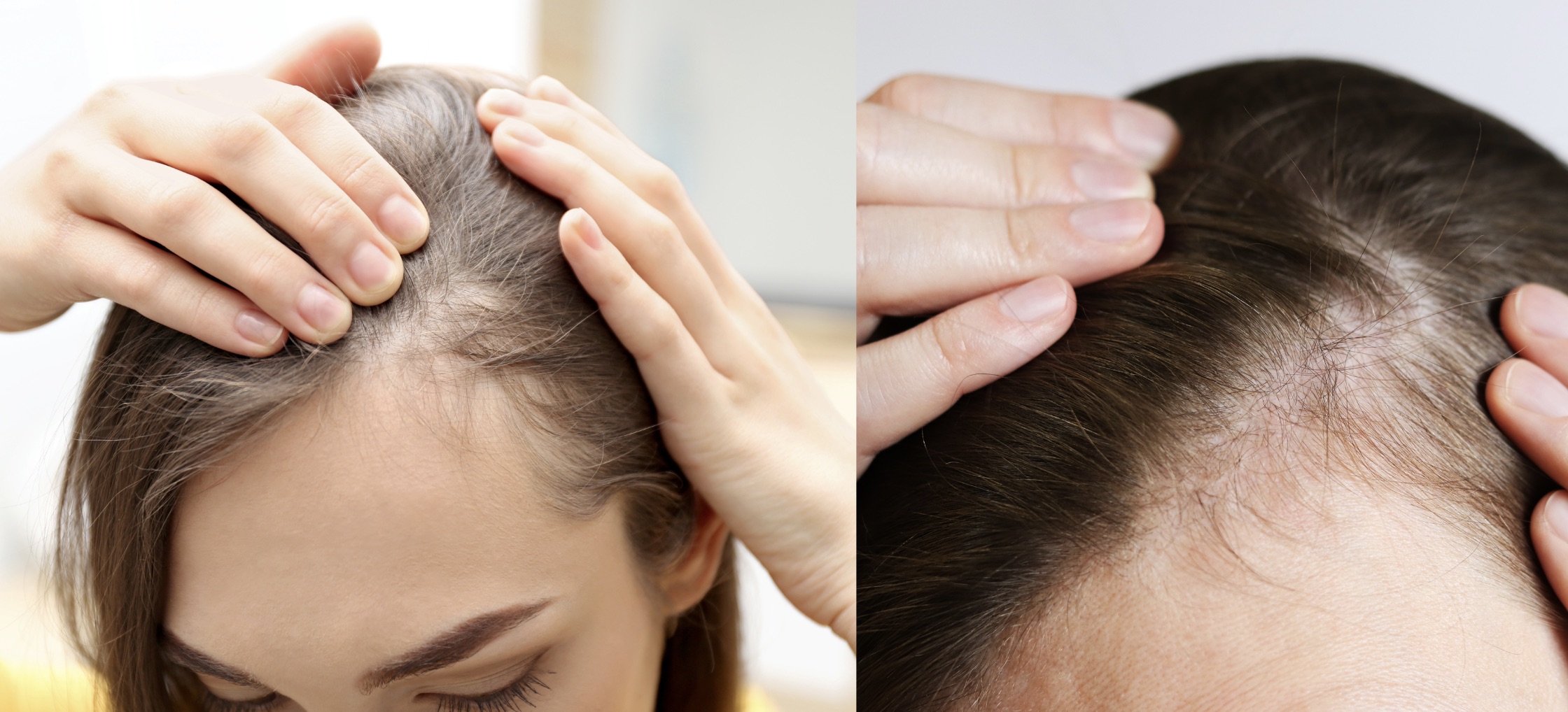 PP405 : Bientôt disponible. Les meilleurs traitements anti-chute et repousse capillaire disponibles sont chez Centre Koel.