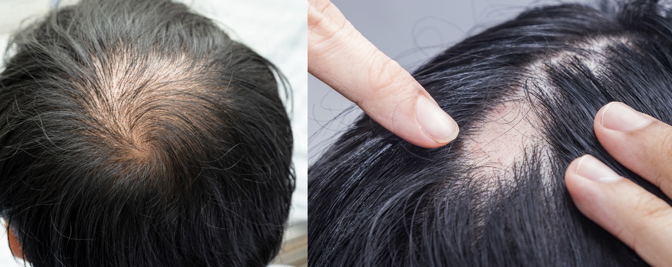 PP405 : Bientôt disponible. Les meilleurs traitements anti-chute et repousse capillaire disponibles sont chez Centre Koel.