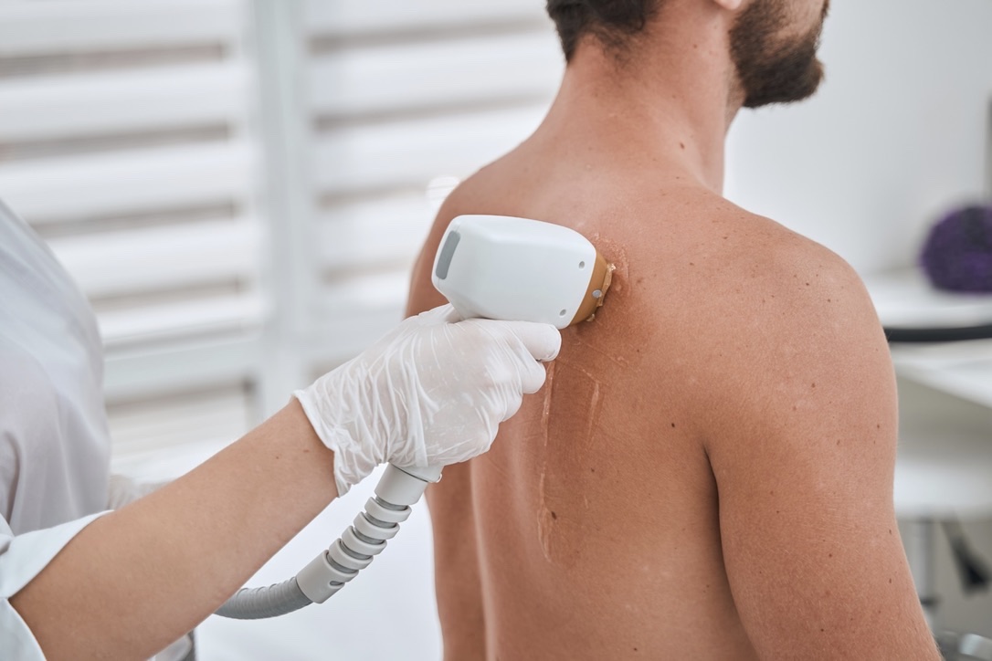 Centre Koel, Expert en Épilation Laser Homme