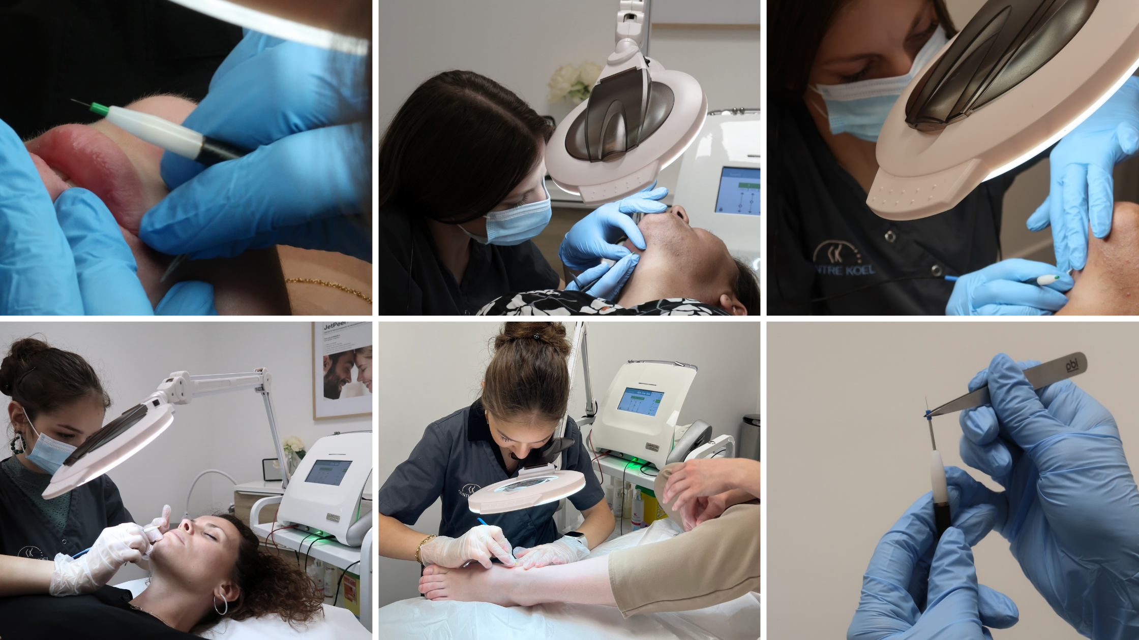 Centre Koel, des centres experts en Épilation Électrique Définitive avec Apilus : Électrolyse, Thermolyse et Blend